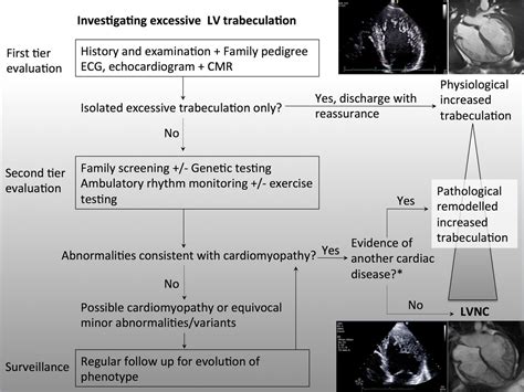 lv compaction|non compaction cardiomyopathy guidelines.